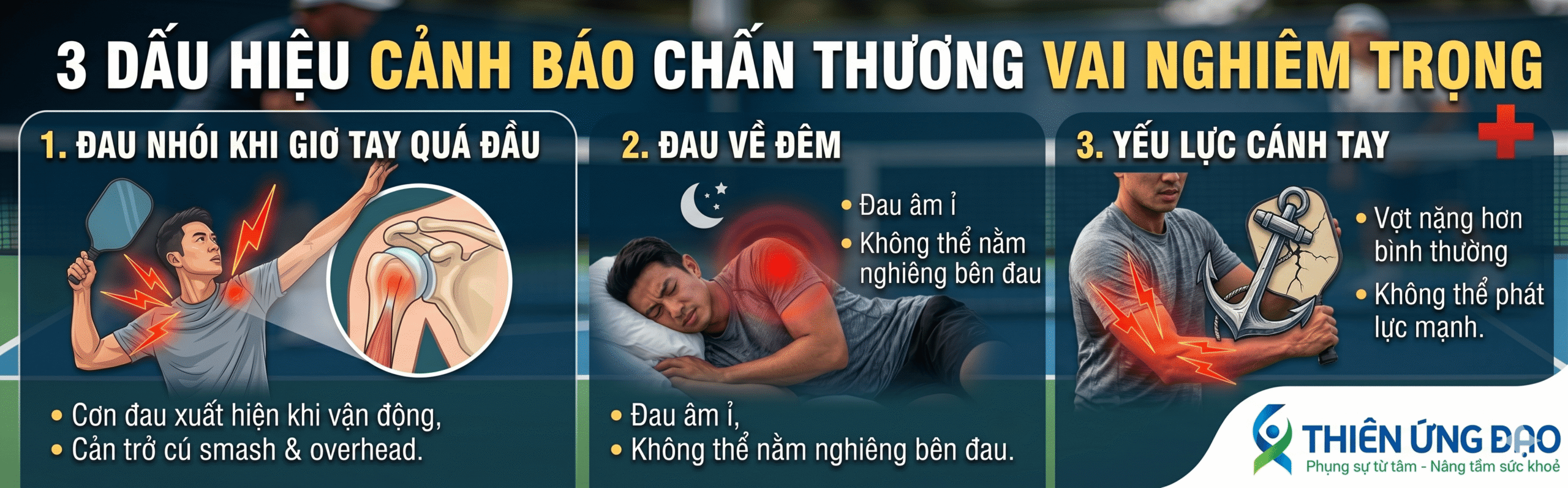3 Dấu hiệu cảnh báo đau vai khi chơi Pickleball cần lưu ý